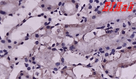 Human EDN1 Polyclonal Antibody