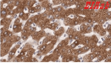Human ENTPD5 Polyclonal Antibody
