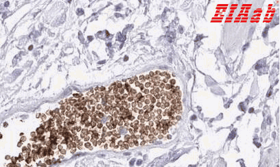 Human EPB42 Polyclonal Antibody