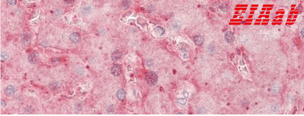 Human F11 Polyclonal Antibody