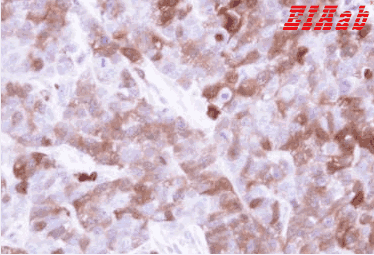 Human F13A1 Polyclonal Antibody