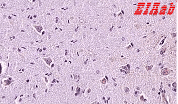 Human GAL Polyclonal Antibody