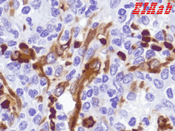 Human HBA1 Polyclonal Antibody