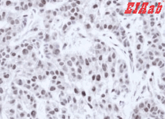 Human HNF1A Polyclonal Antibody