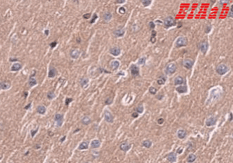 Human IL6 Polyclonal Antibody