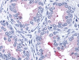 Human ABCA1 Monoclonal Antibody