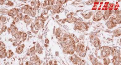 Human MAGEA4 Polyclonal Antibody