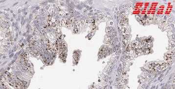 Human MANBA Polyclonal Antibody