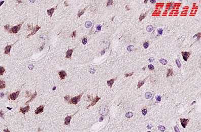 Human NEFH Polyclonal Antibody