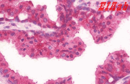 Human BMPR2 Polyclonal Antibody