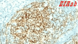 Human VCAM1 Polyclonal Antibody