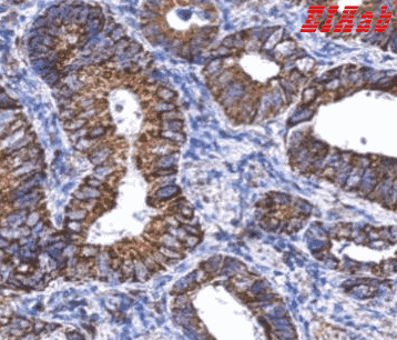 Human ALDH1A1 Polyclonal Antibody