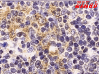 Human TLR9 Polyclonal Antibody