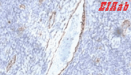 Human VWF Polyclonal Antibody