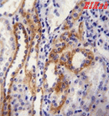 Human ABCC6 Polyclonal Antibody