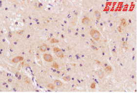 Human TMEM158 Polyclonal Antibody