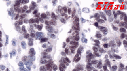 Human WT1 Polyclonal Antibody
