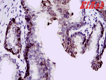 Human BPIFA2 Polyclonal Antibody