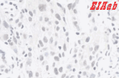 Human ZEB1 Polyclonal Antibody