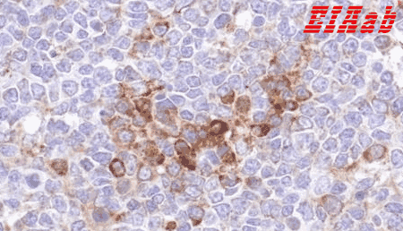 Human VIPR1 Polyclonal Antibody