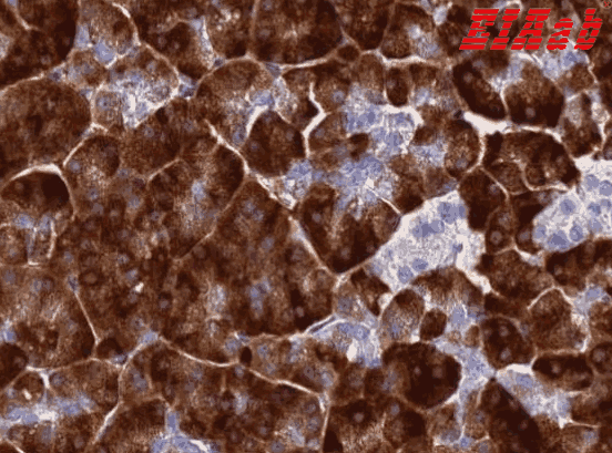 Human AQP12A Polyclonal Antibody