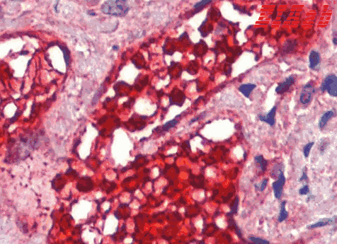 Human CA1 Polyclonal Antibody