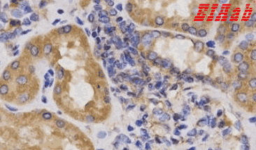 Human WIF1 Polyclonal Antibody