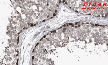 Human ZNF654 Polyclonal Antibody