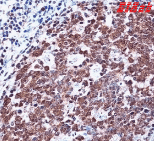 Human ZAP70 Polyclonal Antibody
