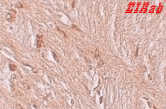 Human ZBTB3 Polyclonal Antibody