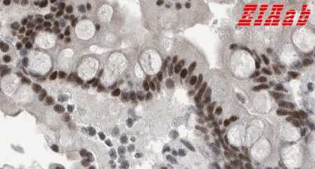 Human RBM6 Polyclonal Antibody