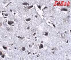 Human RCAN2 Polyclonal Antibody