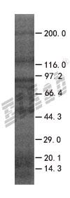 ARHGAP24 293T Cell Transient Overexpression Lysate(Denatured)