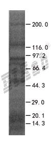 EGFL7 293T Cell Transient Overexpression Lysate(Denatured)