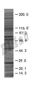FGF1 293T Cell Transient Overexpression Lysate(Denatured)