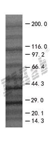 BAK1 293T Cell Transient Overexpression Lysate(Denatured)