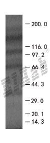 BID 293T Cell Transient Overexpression Lysate(Denatured)
