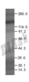 CASP7 293T Cell Transient Overexpression Lysate(Denatured)