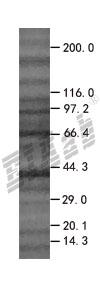 CIDE-3 293T Cell Transient Overexpression Lysate(Denatured)