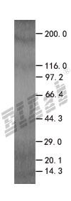 CRADD HEK293 Cell Transient Overexpression Lysate(Non-Denatured)