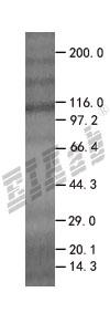EGLN3 293T Cell Transient Overexpression Lysate(Denatured)