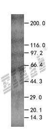 FEM1B 293T Cell Transient Overexpression Lysate(Denatured)