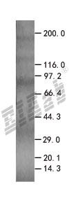 GADD45A 293T Cell Transient Overexpression Lysate(Denatured)