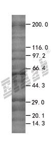 ICEBERG 293T Cell Transient Overexpression Lysate(Denatured)