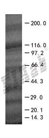 BIRC4BP 293T Cell Transient Overexpression Lysate(Denatured)
