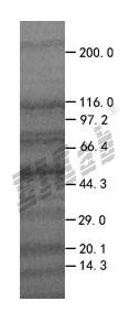 PACAP 293T Cell Transient Overexpression Lysate(Denatured)