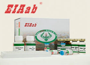Human ABLIM2 ELISA Kit